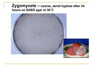 Zygomycete – coarse, aerial hyphae after 24
hours on SABS agar at 30˚C
 