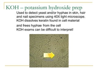 Used to detect yeast and/or hyphae in skin, hair
and nail specimens using 40X light microscope.
KOH dissolves keratin found in cell material
and frees hyphae from the cell
KOH exams can be difficult to interpret!
KOH – potassium hydroxide prep
 