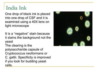 One drop of black ink is placed
into one drop of CSF and it is
examined using a 40X lens on
light microscope
It is a “negative” stain because
it stains the background not the
yeast
The clearing is the
polysaccharide capsule of
Cryptococcus neoformans or
C. gattii. Specificity is improved
if you look for budding yeast
cells.
India Ink
 