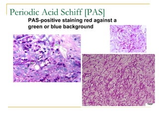 PAS-positive staining red against a
green or blue background
Periodic Acid Schiff [PAS]
 