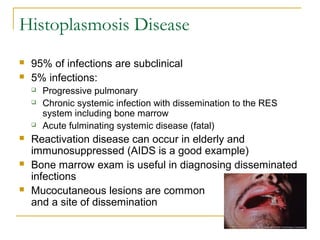 Histoplasmosis Disease
 95% of infections are subclinical
 5% infections:
 Progressive pulmonary
 Chronic systemic infection with dissemination to the RES
system including bone marrow
 Acute fulminating systemic disease (fatal)
 Reactivation disease can occur in elderly and
immunosuppressed (AIDS is a good example)
 Bone marrow exam is useful in diagnosing disseminated
infections
 Mucocutaneous lesions are common
and a site of dissemination
 