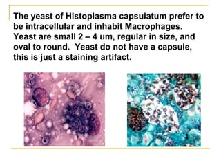 The yeast of Histoplasma capsulatum prefer to
be intracellular and inhabit Macrophages.
Yeast are small 2 – 4 um, regular in size, and
oval to round. Yeast do not have a capsule,
this is just a staining artifact.
 