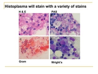 H & E PAS
Gram Wright’s
Histoplasma will stain with a variety of stains
 