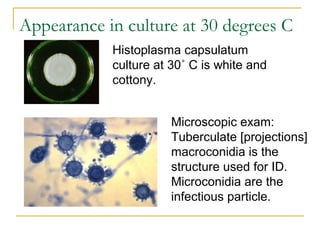 Histoplasma capsulatum
culture at 30˚ C is white and
cottony.
Microscopic exam:
Tuberculate [projections]
macroconidia is the
structure used for ID.
Microconidia are the
infectious particle.
Appearance in culture at 30 degrees C
 
