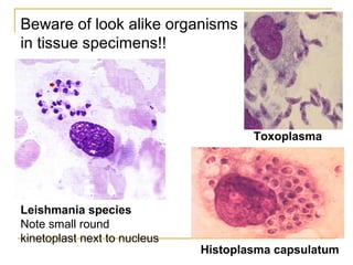 Leishmania species
Note small round
kinetoplast next to nucleus
Toxoplasma
Histoplasma capsulatum
Beware of look alike organisms
in tissue specimens!!
 