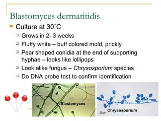 Blastomyces dermatitidis
 Culture at 30˚C
 Grows in 2- 3 weeks
 Fluffy white – buff colored mold, prickly
 Pear shaped conidia at the end of supporting
hyphae – looks like lollipops
 Look alike fungus – Chrysosporium species
 Do DNA probe test to confirm identification
Blastomyces
Chrysosporium
 
