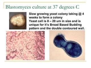 Slow growing yeast colony taking @ 4
weeks to form a colony
Yeast cell is 8 – 20 um in size and is
unique for it’s Broad Based Budding
pattern and the double contoured wall.
Blastomyces culture at 37 degrees C
 