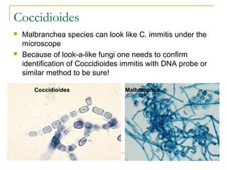 Coccidioides
 Malbranchea species can look like C. immitis under the
microscope
 Because of look-a-like fungi one needs to confirm
identification of Coccidioides immitis with DNA probe or
similar method to be sure!
Coccidioides Malbranchea
 