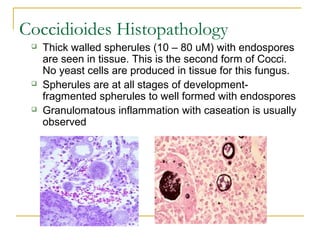 Coccidioides Histopathology
 Thick walled spherules (10 – 80 uM) with endospores
are seen in tissue. This is the second form of Cocci.
No yeast cells are produced in tissue for this fungus.
 Spherules are at all stages of development-
fragmented spherules to well formed with endospores
 Granulomatous inflammation with caseation is usually
observed
 