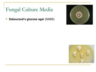 Fungal Culture Media
 Sabouraud’s glucose agar (SABS)
 
