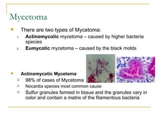 Mycetoma
 There are two types of Mycetoma:
1. Actinomycotic mycetoma – caused by higher bacteria
species
2. Eumycotic mycetoma – caused by the black molds
 Actinomycotic Mycetoma
 98% of cases of Mycetoma
 Nocardia species most common cause
 Sulfur granules formed in tissue and the granules vary in
color and contain a matrix of the filamentous bacteria
 