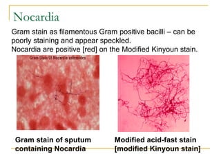 Gram stain as filamentous Gram positive bacilli – can be
poorly staining and appear speckled.
Nocardia are positive [red] on the Modified Kinyoun stain.
Modified acid-fast stain
[modified Kinyoun stain]
Gram stain of sputum
containing Nocardia
Nocardia
 
