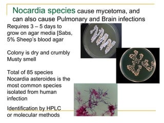 Requires 3 – 5 days to
grow on agar media [Sabs,
5% Sheep’s blood agar
Colony is dry and crumbly
Musty smell
Total of 85 species
Nocardia asteroides is the
most common species
isolated from human
infection
Identification by HPLC
or molecular methods
Nocardia species cause mycetoma, and
can also cause Pulmonary and Brain infections
 