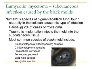 Eumycotic mycetoma – subcutaneous
infection caused by the black molds
Numerous species of pigmented/black fungi found
naturally in the soil can cause this type of infection
Cause @ 2% of cases of mycetoma
Traumatic implantation injects the mold into the
subcutaneous tissue
Most common species of black mold include:
Cladophialophora (Cladosporium) carrionii
Cladophialophora bantiana
Phialophora verrucosa
Fonsecaea pedrosoi
Exophiala species
Wangiella species
 