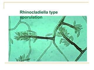 Rhinocladiella type
sporulation
 