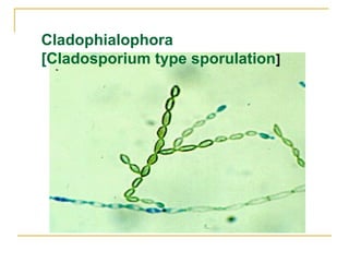 Cladophialophora
[Cladosporium type sporulation]
 