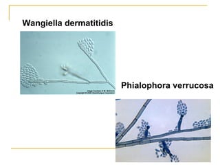 Wangiella dermatitidis
Phialophora verrucosa
 
