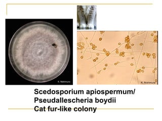 Scedosporium apiospermum/
Pseudallescheria boydii
Cat fur-like colony
 