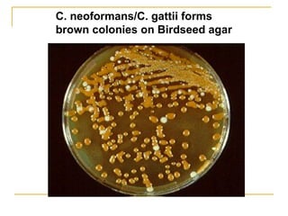 C. neoformans/C. gattii forms
brown colonies on Birdseed agar
 
