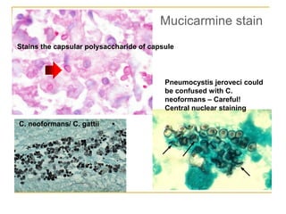 Mucicarmine stain
Stains the capsular polysaccharide of capsule
Pneumocystis jeroveci could
be confused with C.
neoformans – Careful!
Central nuclear staining
C. neoformans/ C. gattii
 