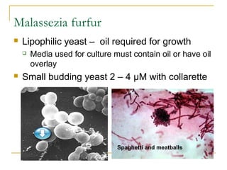 Malassezia furfur
 Lipophilic yeast – oil required for growth
 Media used for culture must contain oil or have oil
overlay
 Small budding yeast 2 – 4 µM with collarette
Spaghetti and meatballs
 