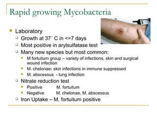 Rapid growing Mycobacteria


Laboratory




Growth at 37˚ C in <=7 days
Most positive in arylsulfatase test
Many new s...