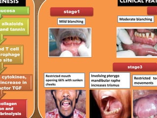 ENESIS CLINICAL FEAT
collagen
on and
ibrinolysis
n cytokines,
increase in
actor TGF
ed T cell
crophage
e site
t alkaloids
and tannin
mucosa stage1
stage3
S
Restricted mouth
opening 66% with sunken
cheeks
Restricted ton
movements
Mild blanching
Moderate blanching
Involving pterygo
mandibular raphe
increases trismus
 