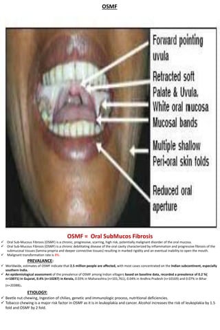 OSMF
OSMF = Oral SubMucos Fibrosis
 Oral Sub-Mucous Fibrosis (OSMF) is a chronic, progressive, scarring, high risk, potentially malignant disorder of the oral mucosa.
 Oral Sub-Mucous Fibrosis (OSMF) is a chronic debilitating disease of the oral cavity characterized by inflammation and progressive fibrosis of the
submucosal tissues (lamina propria and deeper connective tissues) resulting in marked rigidity and an eventual inability to open the mouth.
 Malignant transformation rate is 8%.
PREVALANCE:
 Worldwide, estimates of OSMF indicate that 2.5 million people are affected, with most cases concentrated on the Indian subcontinent, especially
southern India.
 An epidemiological assessment of the prevalence of OSMF among Indian villagers based on baseline data, recorded a prevalence of 0.2 %(
n=10071) in Gujarat, 0.4% (n=10287) in Kerala, 0.03% in Maharashtra (n=101,761), 0.04% in Andhra Pradesh (n=10169) and 0.07% in Bihar
(n=20388).
ETIOLOGY:
 Beetle nut chewing, Ingestion of chilies, genetic and immunologic process, nutritional deficiencies.
 Tobacco chewing is a major risk factor in OSMF as it is in leukoplakia and cancer. Alcohol increases the risk of leukoplakia by 1.5
fold and OSMF by 2 fold.
 