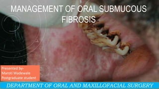 MANAGEMENT OF ORAL SUBMUCOUS
FIBROSIS
Presented by-
Maroti Wadewale
Postgraduate student
DEPARTMENT OF ORAL AND MAXILLOFACIAL SURGERY
 