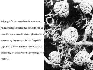 Micrografia de varredura da estruturas
relacionadas à microcirculação do rim de
mamífero, mostrando vários glomérulos e
vasos sanguineos associados. O epitélio
capsular, que normalmente recobre cada
glomérlo, foi dissolvido na preparação do
material.

 