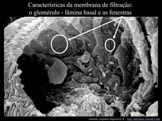 Características da membrana de filtração:
o glomérulo - lâmina basal e as fenestras

extraído, enquanto disponível, d: : http://education.vetmed.vt.edu

 