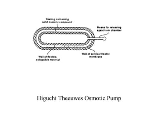 Higuchi Theeuwes Osmotic Pump
 
