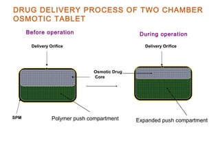 DRUG DELIVERY PROCESS OF TWO CHAMBER
OSMOTIC TABLET
Osmotic Drug
Core
SPM
Delivery Orifice Delivery Orifice
Polymer push compartment Expanded push compartment
Before operation During operation
 
