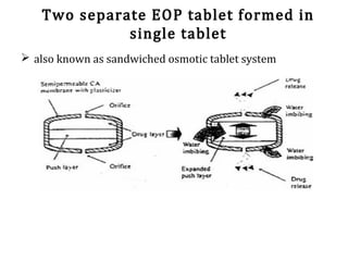 Two separate EOP tablet formed in
single tablet
 also known as sandwiched osmotic tablet system
 