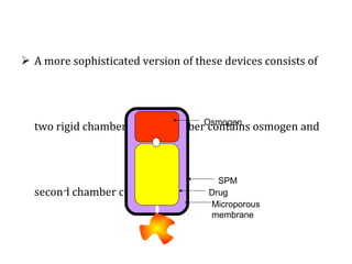  A more sophisticated version of these devices consists of
two rigid chambers : one chamber contains osmogen and
second chamber contain drug
SPM
Drug
Osmogen
Microporous
membrane
 