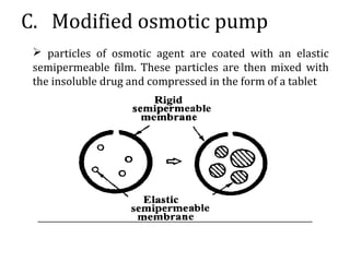 C. Modified osmotic pump
 particles of osmotic agent are coated with an elastic
semipermeable film. These particles are then mixed with
the insoluble drug and compressed in the form of a tablet
 