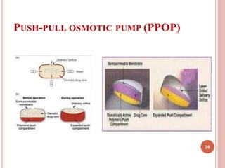 PUSH-PULL OSMOTIC PUMP (PPOP)
26
 