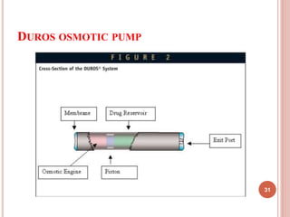 DUROS OSMOTIC PUMP
31
 