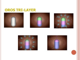 OROS TRI-LAYER
 