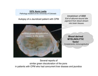 1979: Kevin Leslie
Pathology resident at the University of Colorado

breakdown of BBB
Autopsy of a Jaundiced patient with CPM

striking green discoloration
Lesion in the pons

Exit of albumin-bound bile
pigment from blood stream
into brain tissues.

Blood derived
MYELINOLYTIC
factor
Complements, immunoglobulins

Several reports of
similar green discoloration of the pons
in patients with CPM who had concurrent liver disease and jaundice

 