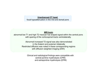Unenhanced CT head
focal hypoattenuation in the mid and dorsal pons

MRI brain
abnormal low T1 and high T2 mexican hat shaped signal within the central pons
with sparing of the corticospinal tracts ventrolaterally.
Abnormal increased T2 signal was also demonstrated
in the thalami and putamen bilaterally
Restricted diffusion was noted in these corresponding regions
with diffusion weighted imaging (DWI)
Clinical and radiological findings were compatible with
central pontine myelinolysis (CPM)
and extrapontine myelinolysis (EPM)

 