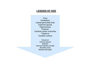 LESIONS OF ODS
Pons
Cerebellum
Lateral geniculate body
External capsule
Hippocampus
Putamen
Cerebral cortex/ subcortex
Thalamus
Caudate nucleus
Claustrum
Internal capsule
Midbrain
Internal medullary lamella
Mamillary body
Medulla oblongata

 