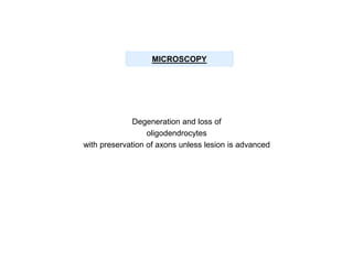 MICROSCOPY

Degeneration and loss of
oligodendrocytes
with preservation of axons unless lesion is advanced

 