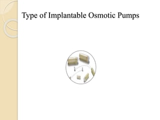 Type of Implantable Osmotic Pumps
 