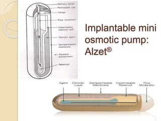 Osmotic drug delivery system | PPTX