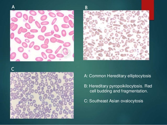 r blood factor test Osmotic membrane defects rbc & 050916 fragility r blood factor test Osmotic membrane defects rbc & 050916 fragility