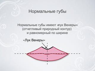 Нормальные губы Нормальные губы имеют «лук Венеры» (отчетливый природный контур)  и равномерный по ширине 