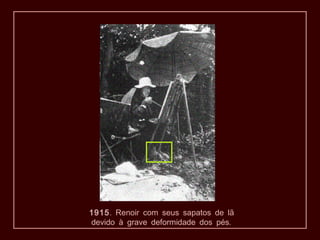 1915. Renoir com seus sapatos de lã
.devido à grave deformidade dos pés
 
