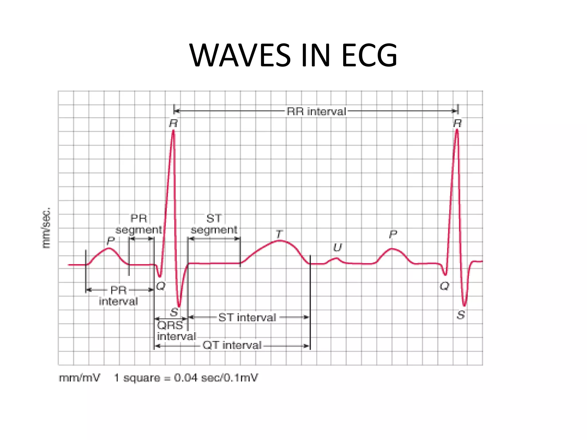 WAVES IN ECG
