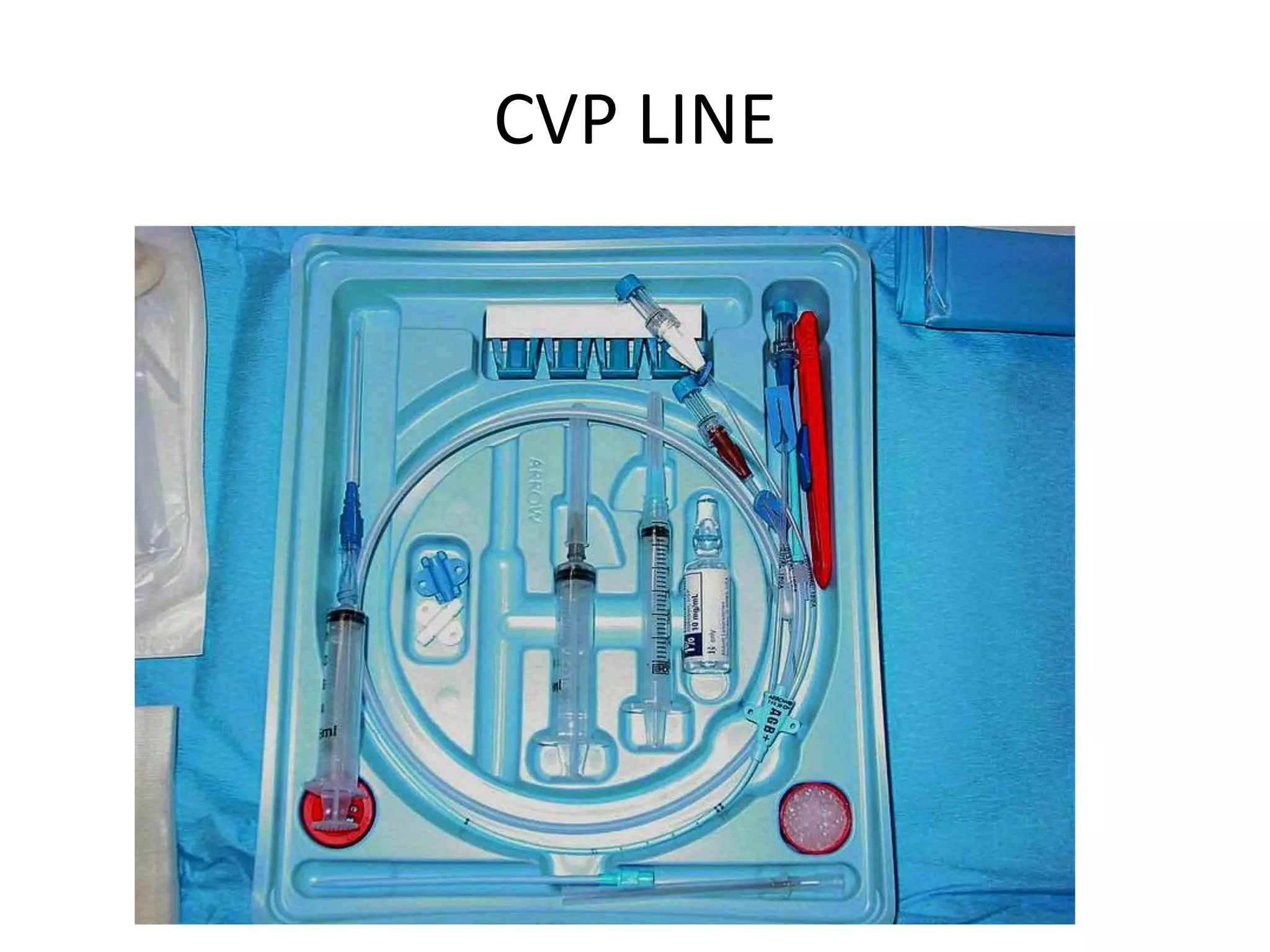 CVP LINE